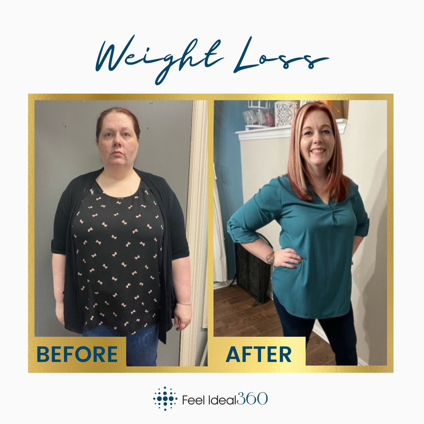 Before After Weight Loss Southlake Texas Feel Ideal 360 Med Spa