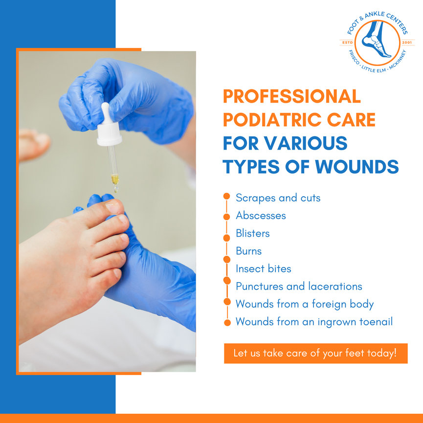 Ingrown Toenail Treatment in Frisco