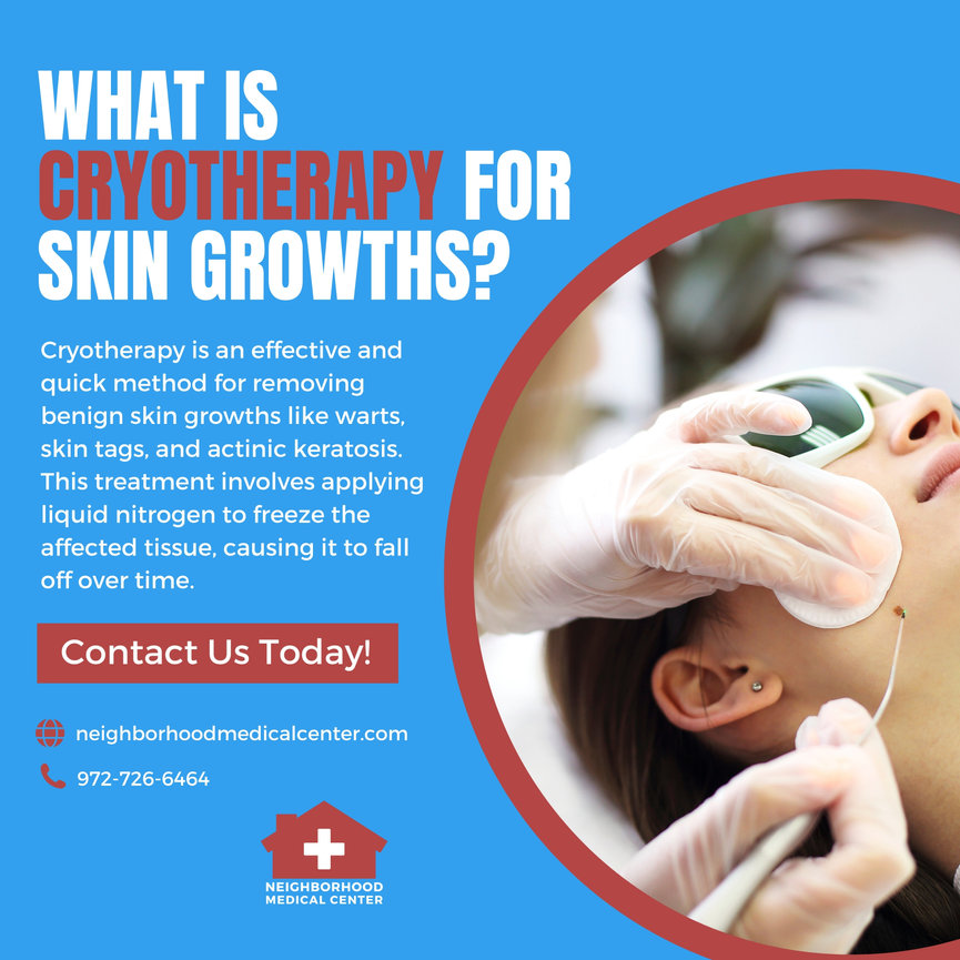 Cryotherapy for Skin Growths Neighborhood Medical Dallas TX